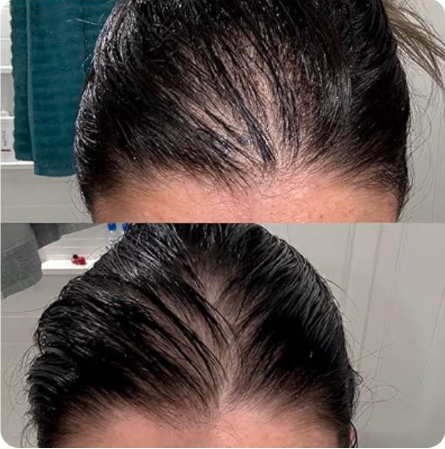 Premium Collagen Peptides